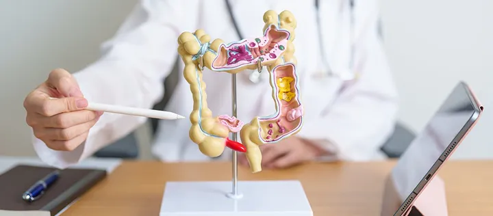 IBD riskfaktor för allvarlig infektion