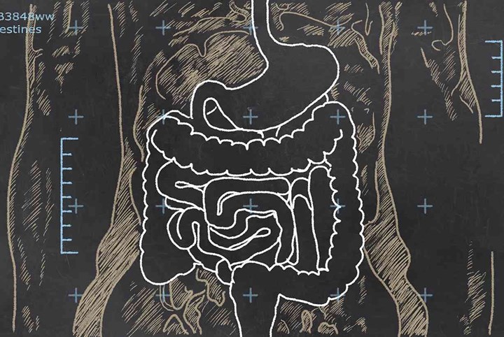 X-ray of Intestines sketched on a Blackboard