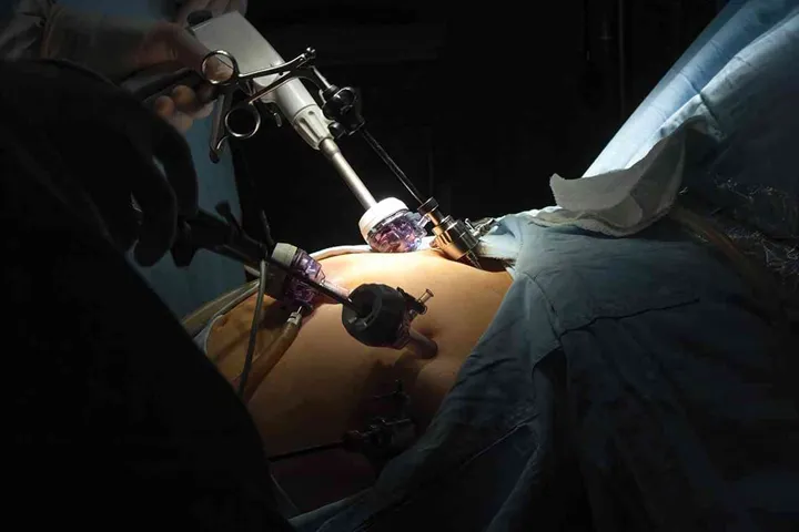 Portrait of gastric bypass surgery in hospital
